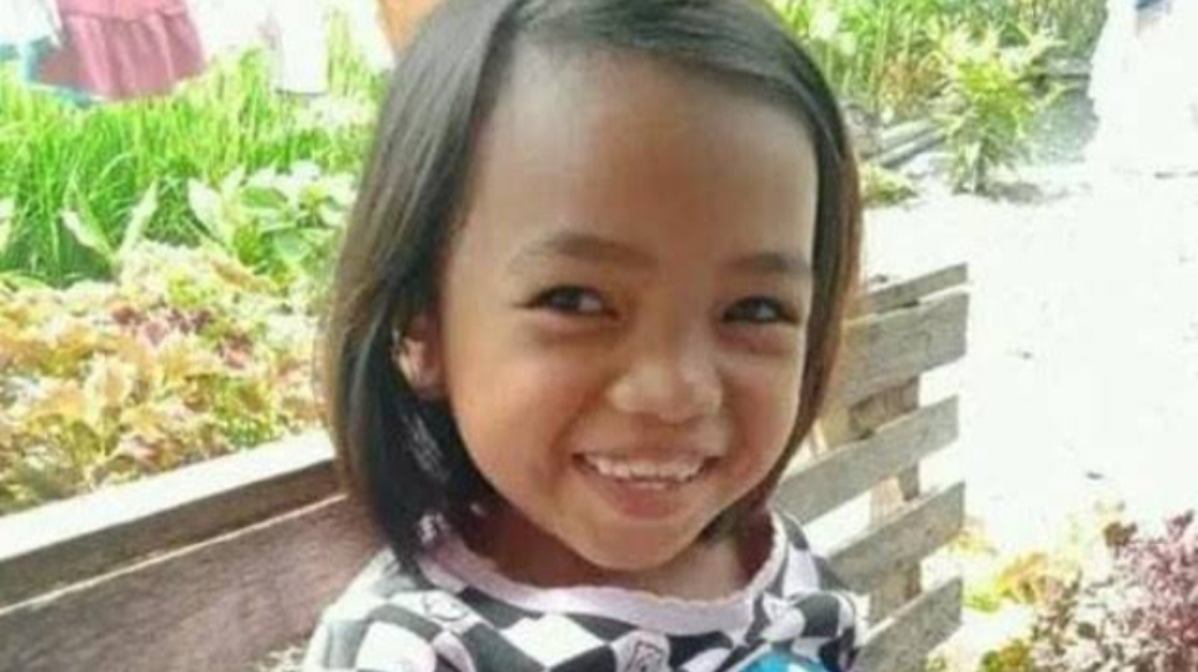 Siswi SD di Sumbar Dibakar Temannya Saat Kerja Bakti. Begini Kronologinya!