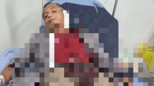 Pengacara Jadi Korban Penusukan Pengamen di Puncak Bogor