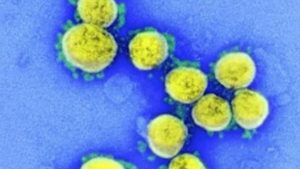 Kena Diazab Tuhan, Virus Mematikan Muncul di Israel yang Tidak Ada Obatnya