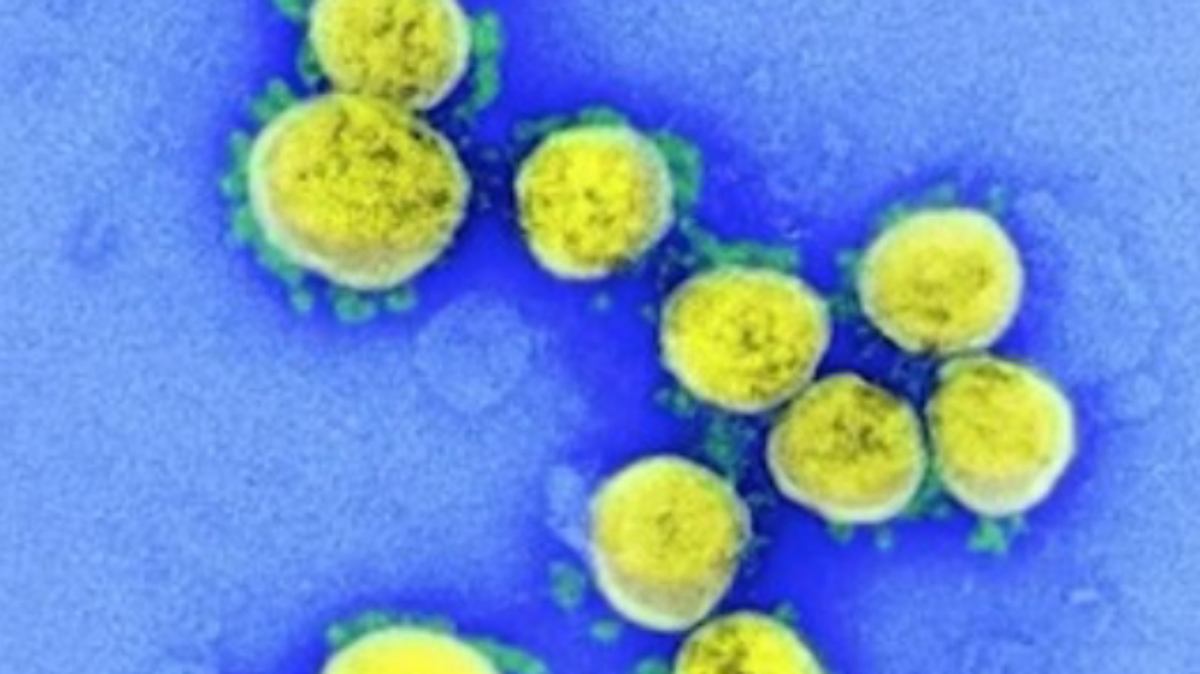 Kena Diazab Tuhan, Virus Mematikan Muncul di Israel yang Tidak Ada Obatnya